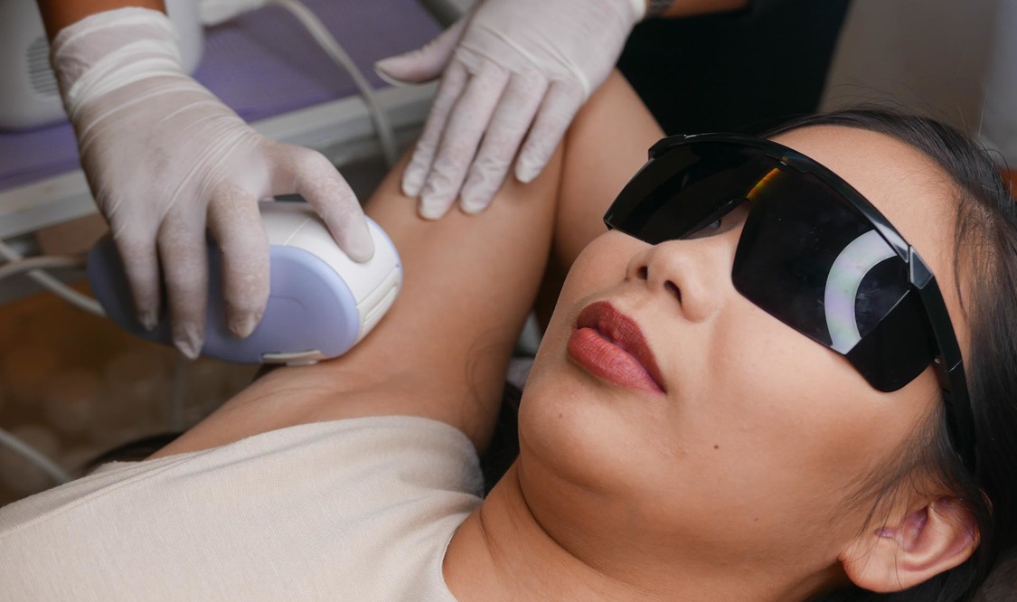 Underarm Laser Hair Removal (Package of 8 Sessions + 2 Free)