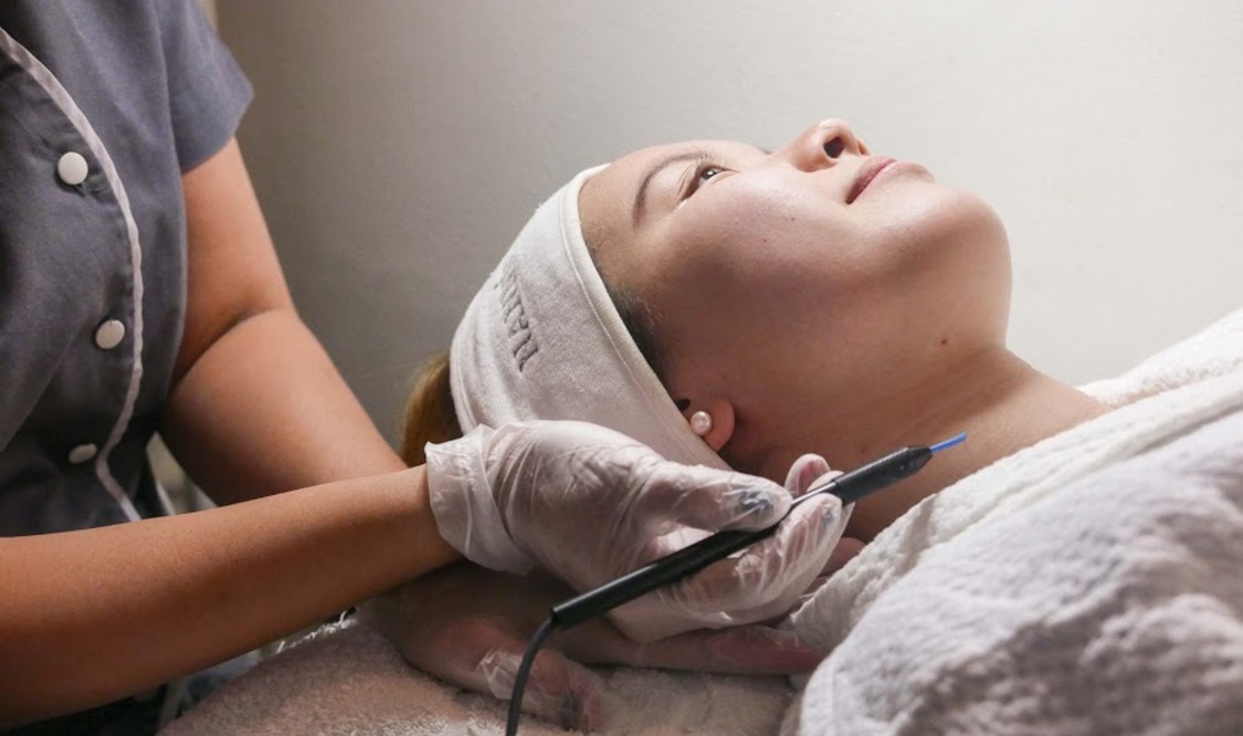 Face and Neck Warts Removal
