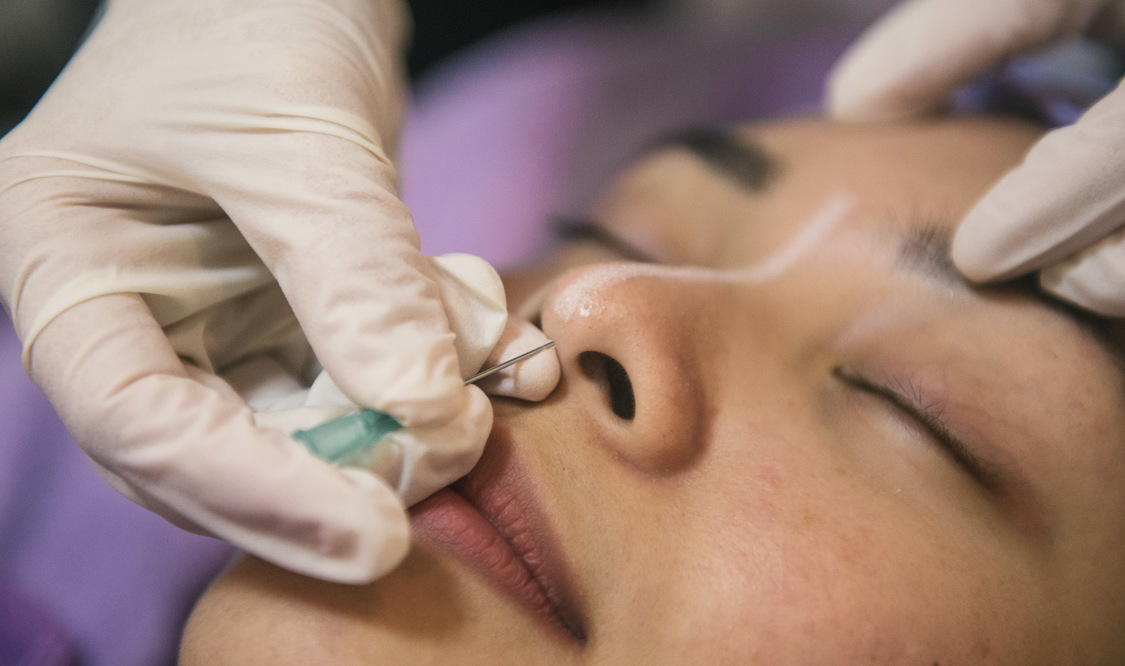 Non-Surgical Noselift