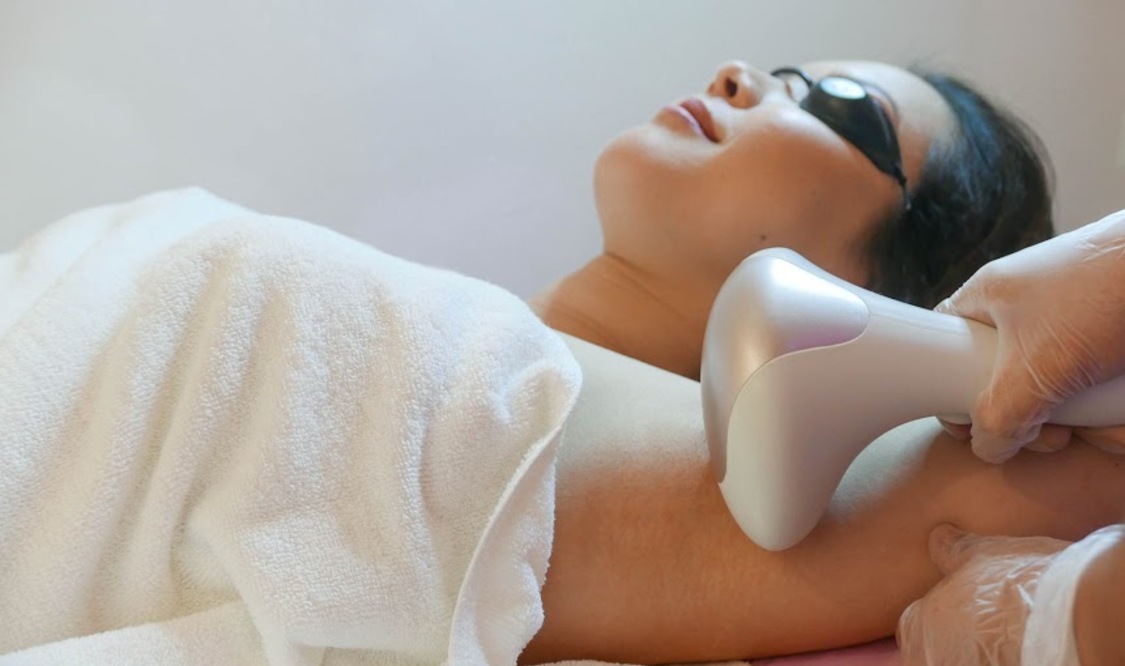 Underarm Laser Hair Removal