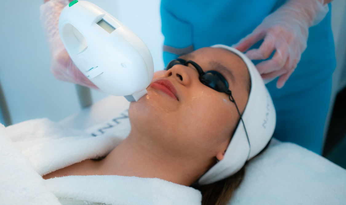 Acne Laser Therapy