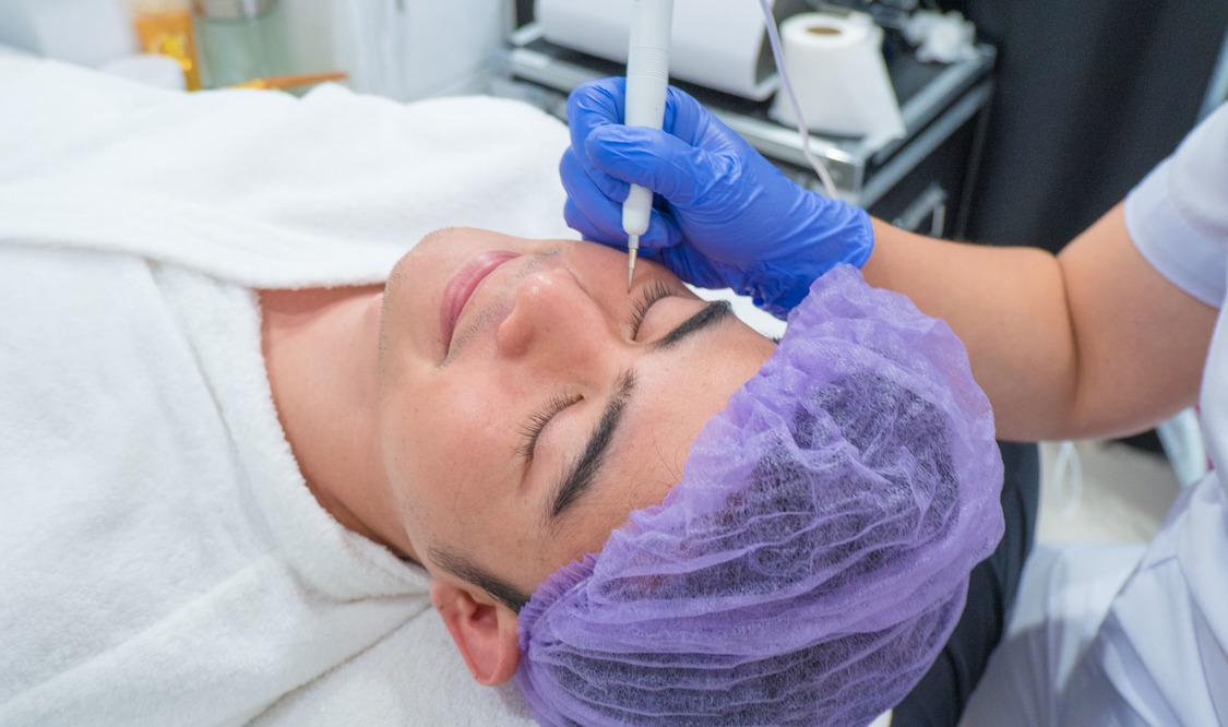 Unlimited Face Warts Removal